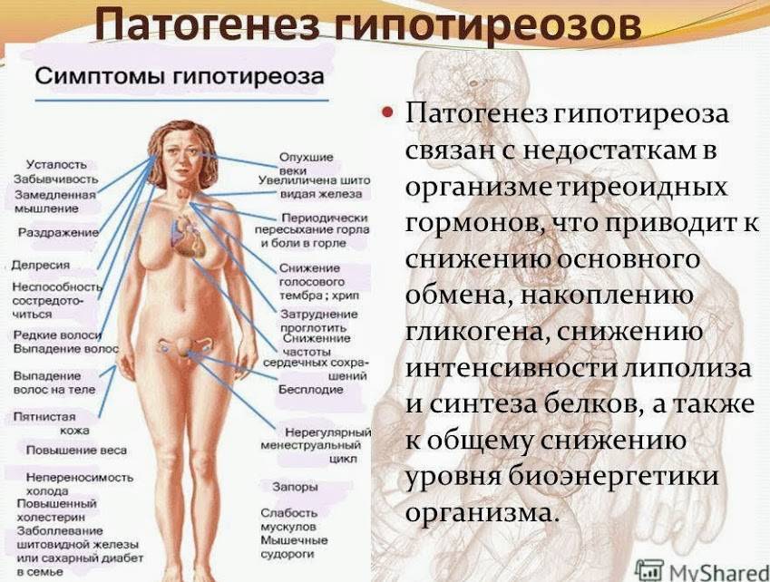 Снижение Веса При Щитовидной Железе