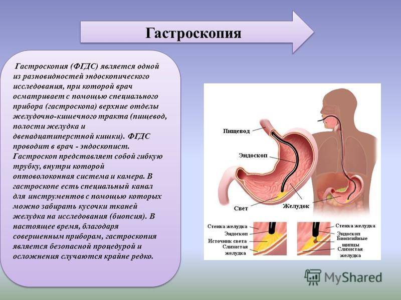 Диета Перед Фгдс Желудка И Двенадцатиперстной Кишки