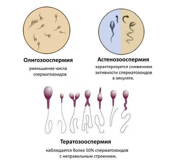 Как лейкоциты влияют на качество спермы?