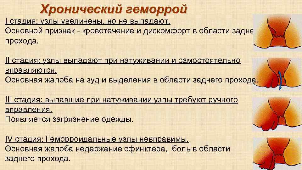 Трещины После Анального Секса