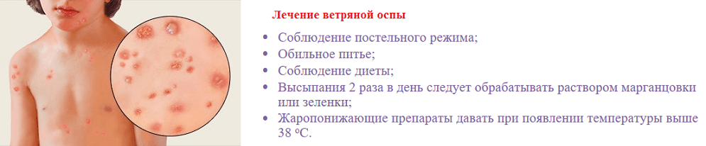 Диета При Ветрянке У Детей 5