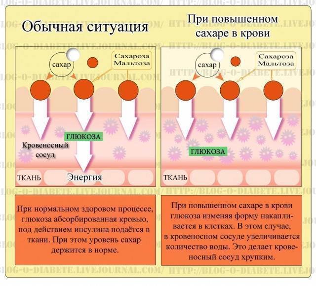 Можно Ли Заниматься Сексом При Всд