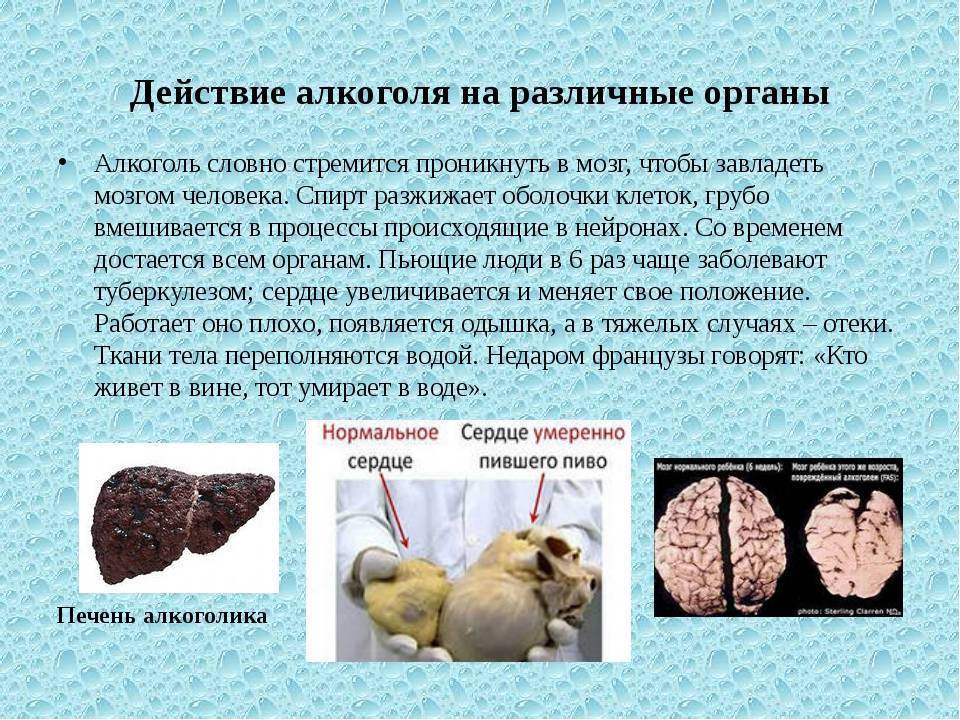 Мозг алкоголика и здорового человека картинки