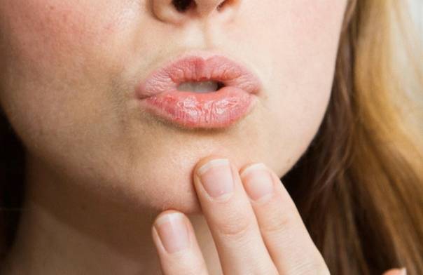 Как избавиться от сухости во рту. основные причины появления сухости во рту