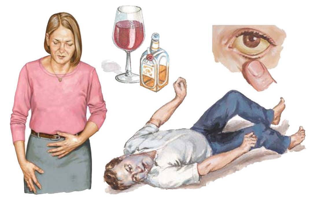 Что делать при рвоте с кровью после употребления алкоголя