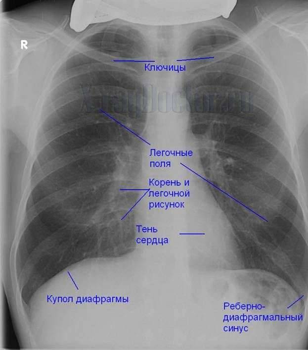 Рентген-снимки здоровых и чистых легких — что должно и не должно быть на них - все о суставах