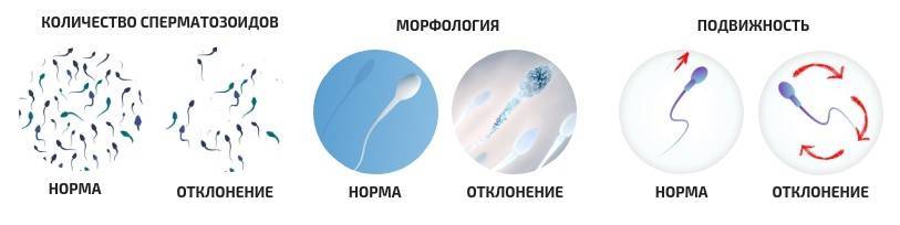 Половая жидкость. Лейкоспермия и пиоспермия. Подвижность сперматозоидов. Подвижные сперматозоиды. Снижение подвижности сперматозоидов.