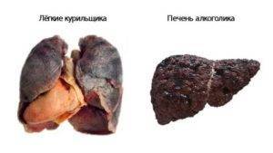Можно ли курить при пневмонии: что происходит в организме