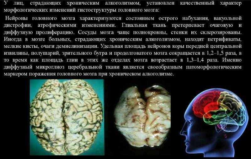 Кома и отек мозга: причины развития, прогноз и последствия