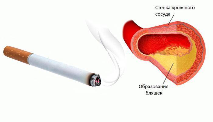 Как действует на сосуды. Влияние курения на кровеносную систему человека. Влияние курения на атеросклероз. Кровеносные сосуды курильщика. Влияние курения табака на кровеносную систему.