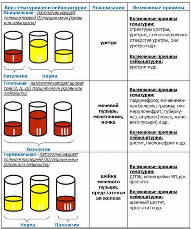 Можно ли пить алкоголь перед сдачей анализов