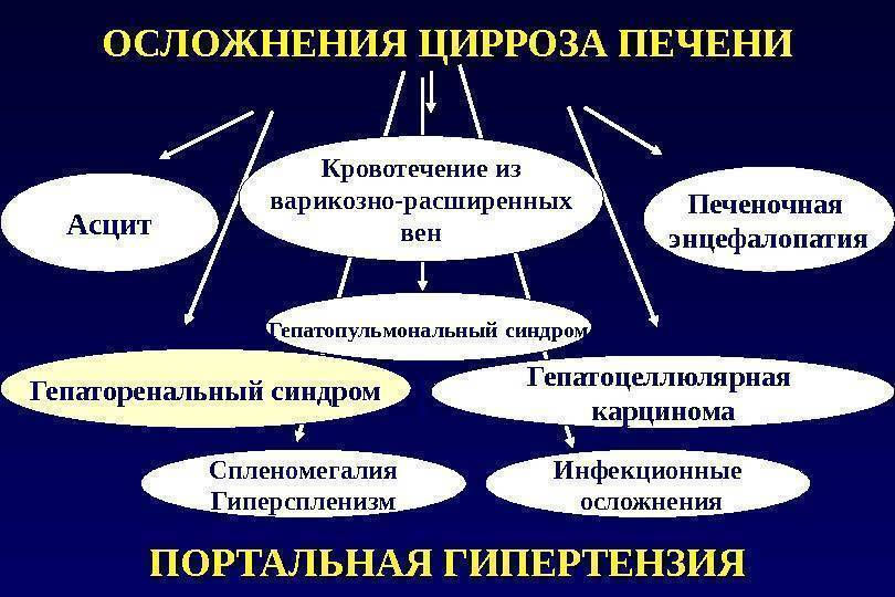 Цирроз печени - симптомы и лечение. признаки и стадии цирроза печени, причины заболевания