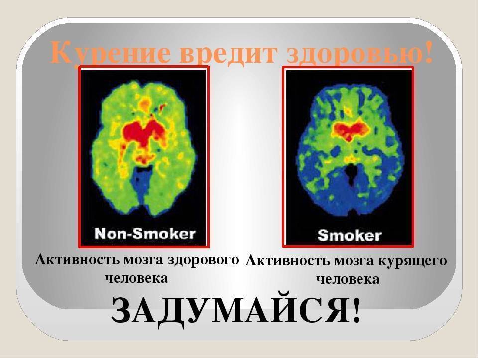 Как никотин влияет на мозг. Влияние курения на головной мозг. Влияние табакокурения на головной мозг.