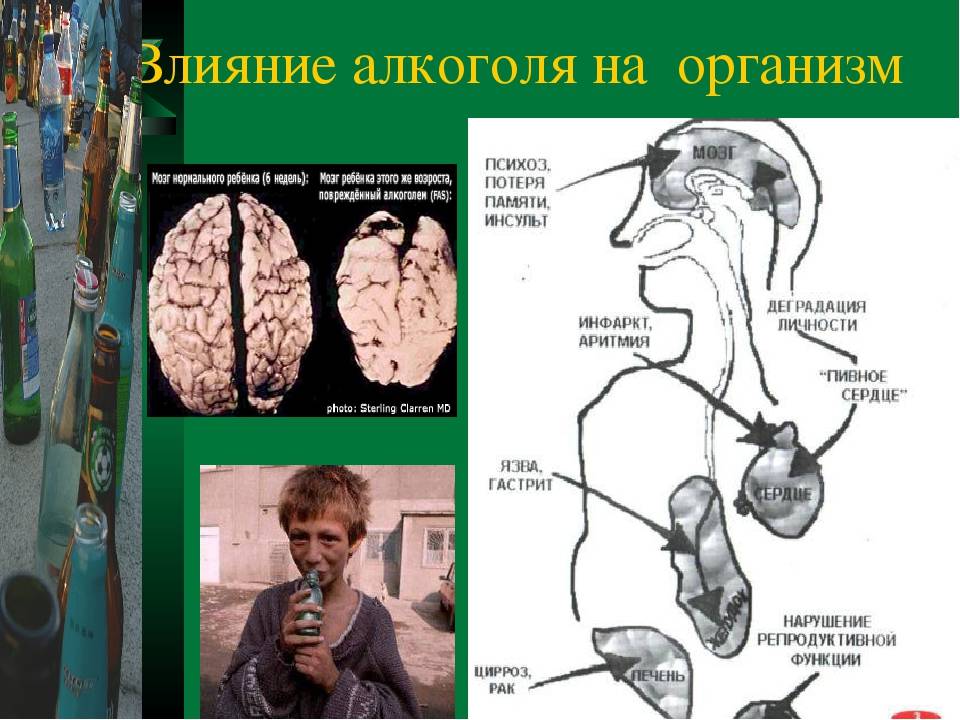 Последствия на организм человека. Механизм воздействия алкоголя. Последствия алкоголя на организм. Алкоголизм последствия для организма. Органы на которые влияет алкоголь.