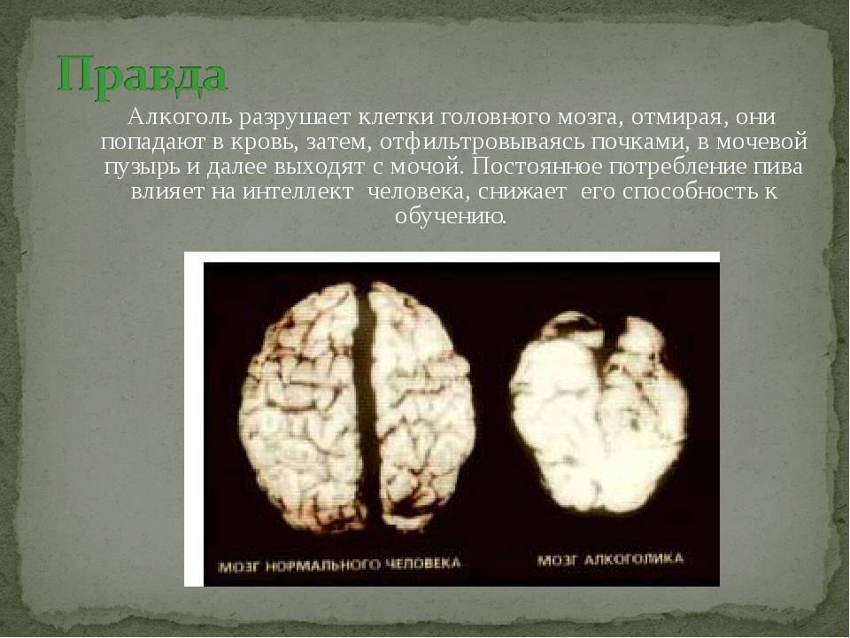 Восстанавливаются ли нейроны головного мозга