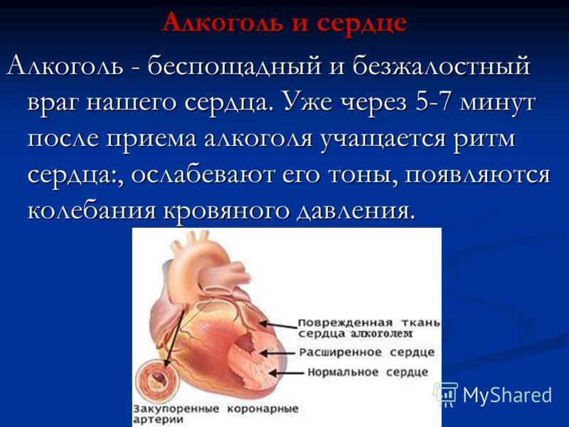 Стенокардия и алкоголь