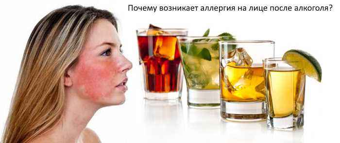 Непереносимость алкоголя: симптомы, причины и лечение