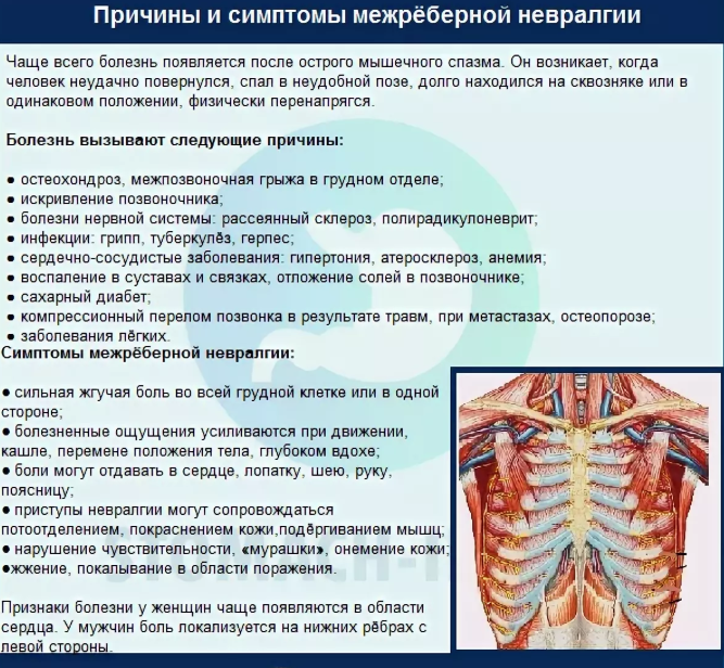 Остеохондроз локальный статус