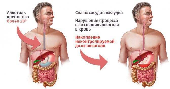 Почему после алкоголя болит желудок?
