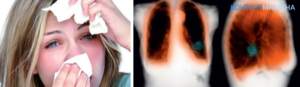 Может ли быть аллергия на сигареты или табачный дым?