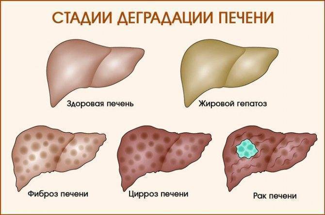 Гепатит б: заразен или нет для окружающих