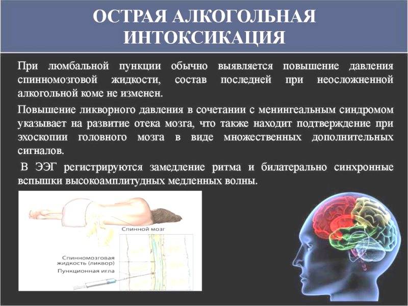 Снятие интоксикации ryazan proalkogolizm