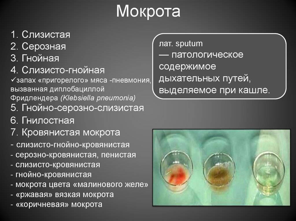 Виды мокроты при кашле описание и фото