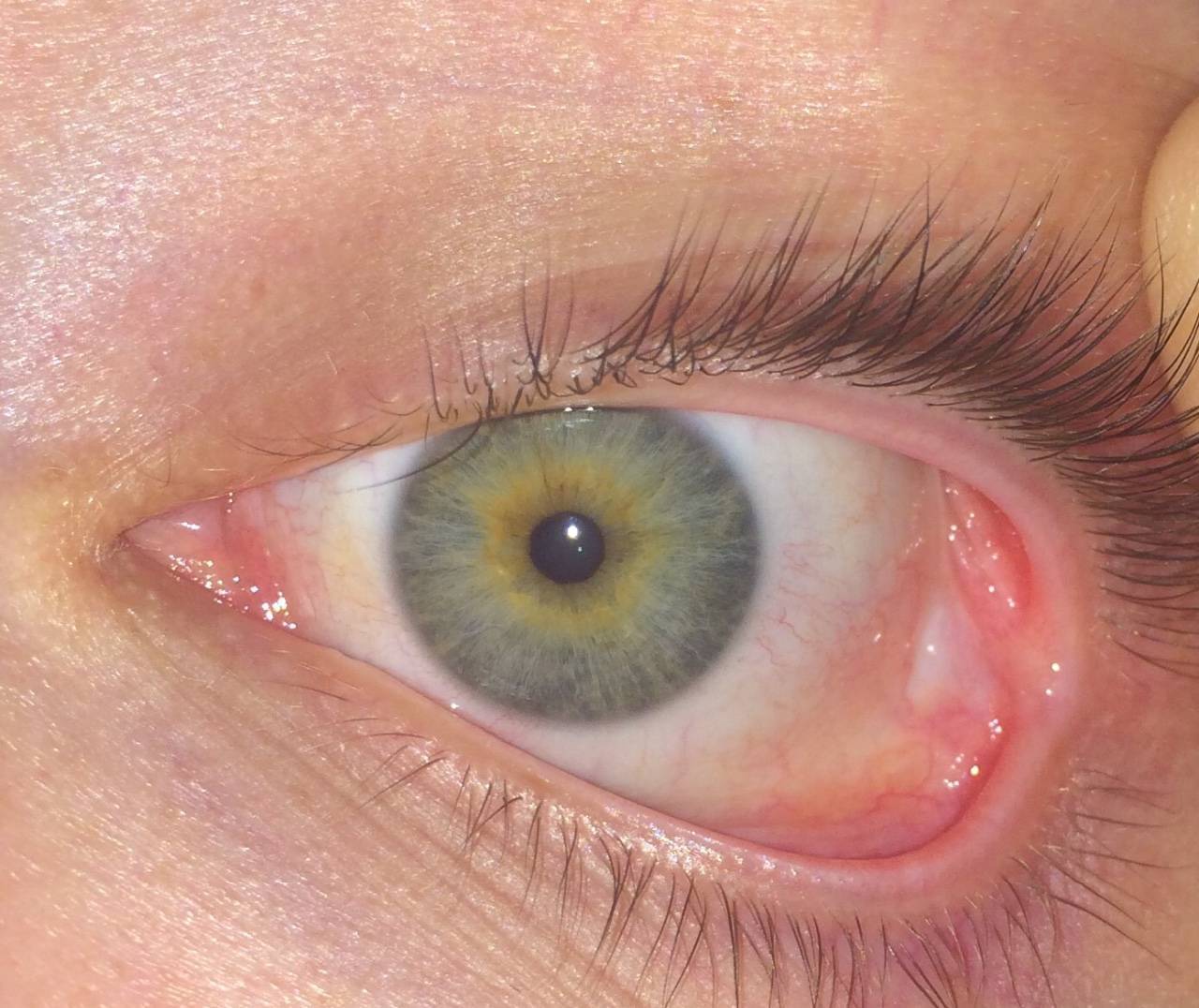 Белки глаз пожелтели – желтые глаза и кожа у человека при гепатите: что делать