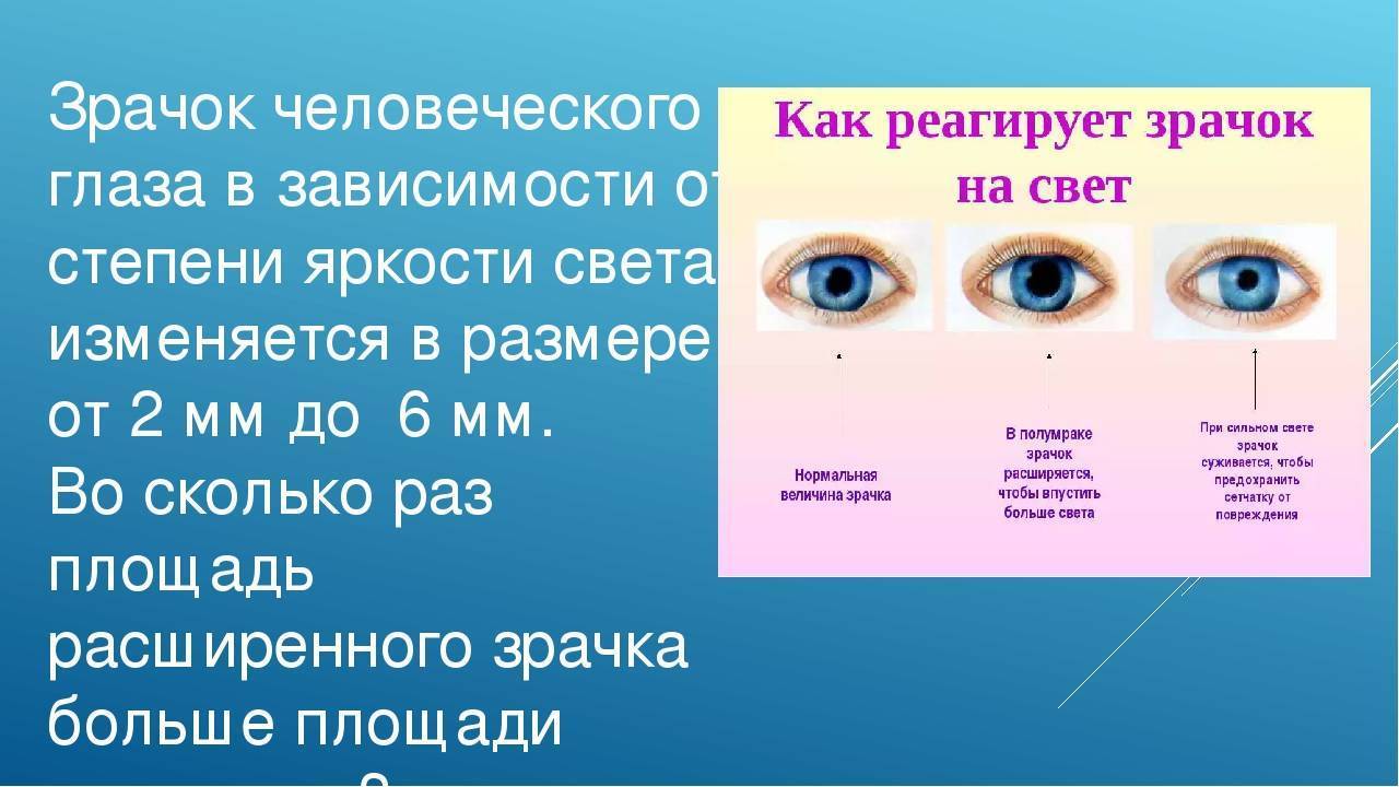 Разные зрачки (анизокория): причины у взрослых и детей, почему один зрачок больше другого, при каких заболеваниях зрачок на одном глазу увеличивается