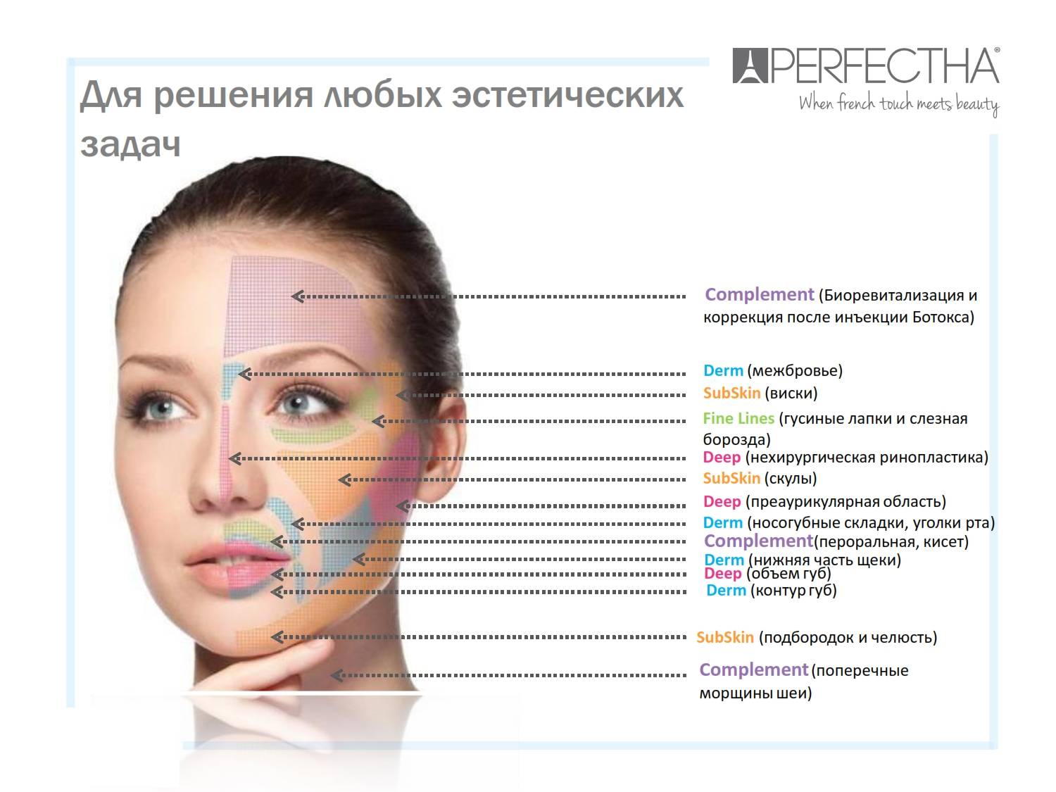 Ботокс лоб и межбровье что нельзя. Схема введения ботокса в межбровье. Зоны введения ботокса на лице. Схема введения ботулотоксина в лоб. Схема введения ботокса на лице.