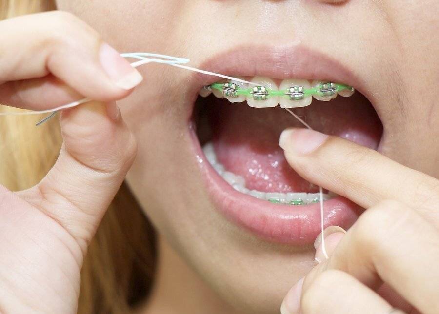 Через сколько есть после удаления зуба: как происходит удаление, какой должна быть диета.
