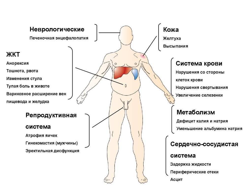 Внешние болезни. Гепатит а место локализации. Гепатит с симптомы у мужчин первые.