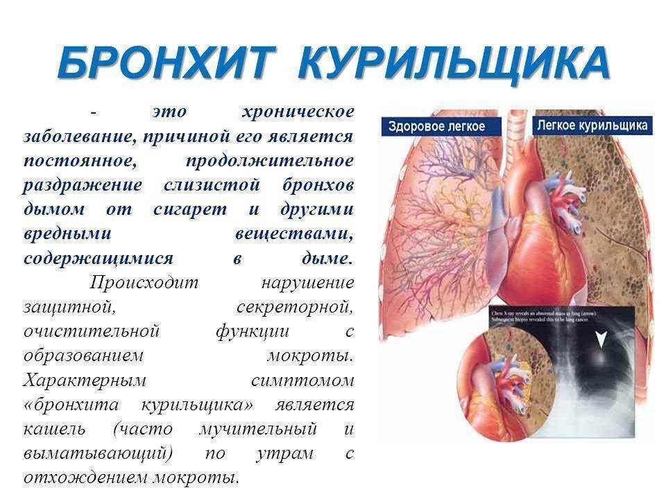Если от курения начинает болеть сердце — чем это вызвано, какие могут быть осложнения?