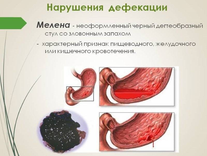 Дегтеобразный черный стул мелена