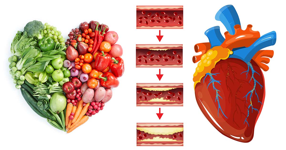 Как курение влияет на холестерин в крови? повышается ли уровень холестерина в крови от курения.