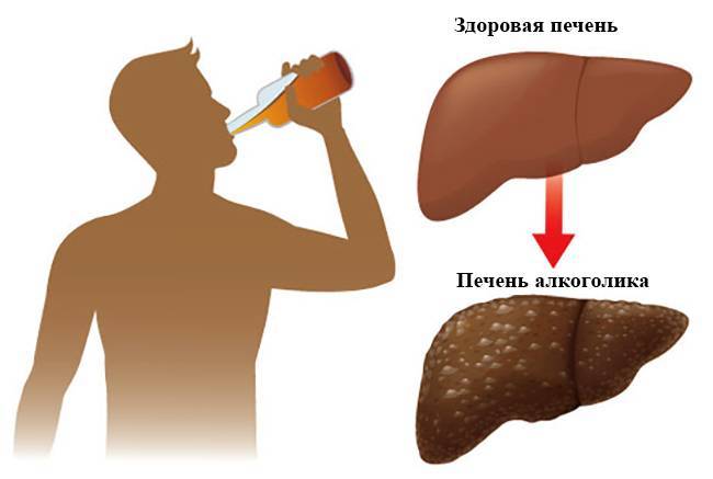 Алкоголь и печень: вред и особенности влияния