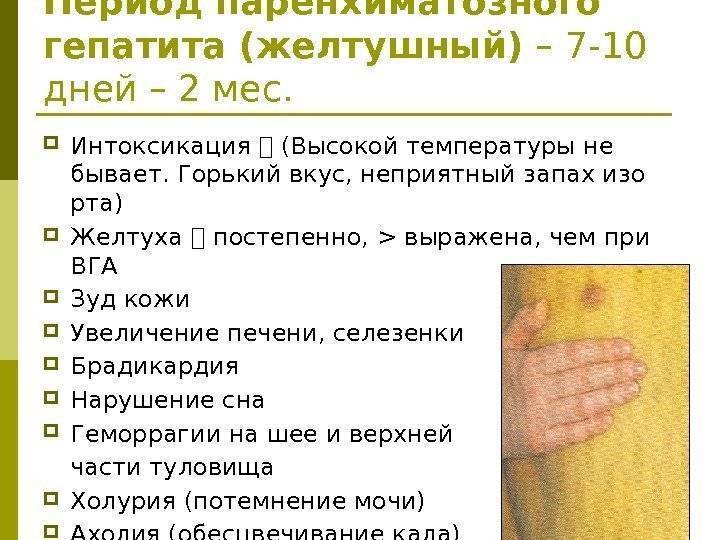 Температура тела при циррозе печени