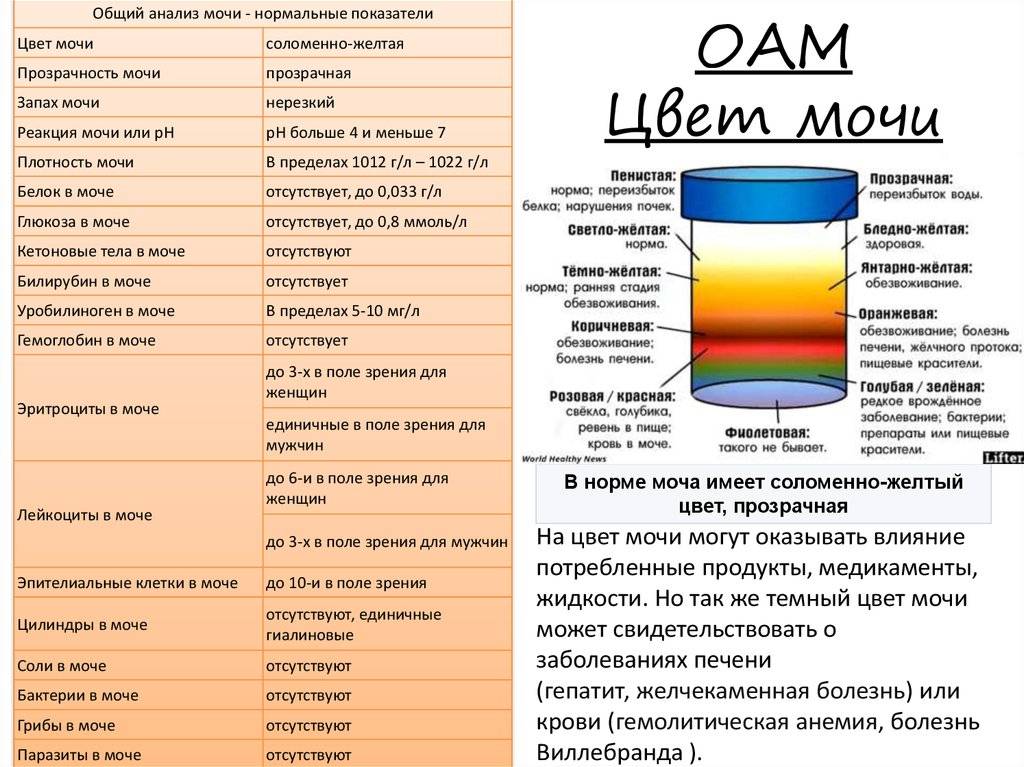 Желтая моча у кота. Цвет мочи. Цвет мочи норма. Темный цвет мочи. Анализ мочи цвет.