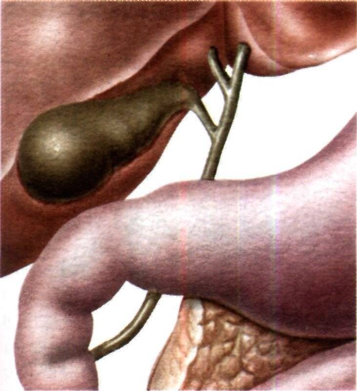 Калькулезный холецистит презентация