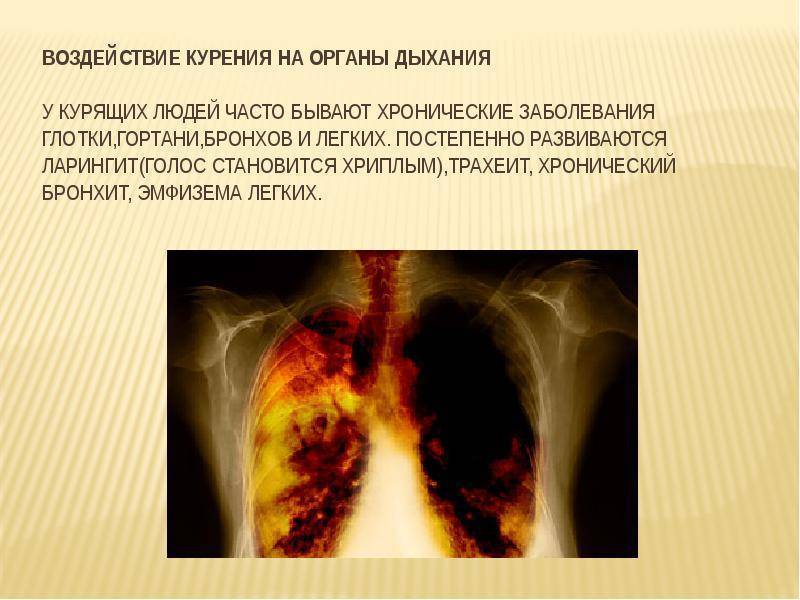 Мокрота курильщика коричневая, серая, с кровью: как избавиться и может ли быть после отказа от курения сигарет?