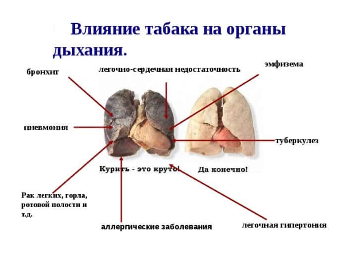 Курение при заболеваниях: при каких патологиях привычка под запретом