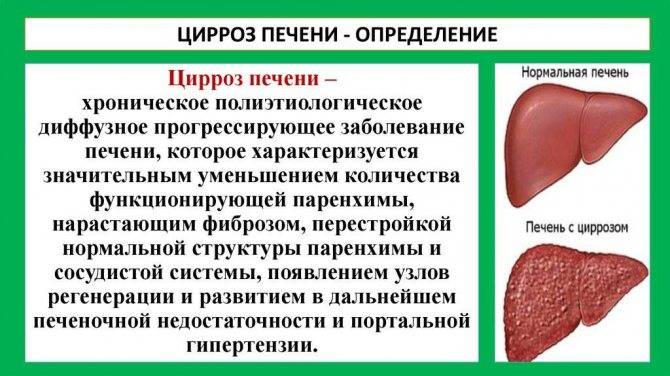 Цирроз и рак печени – это одно и то же или нет