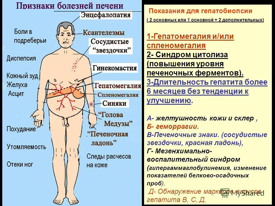 Сосудистый рисунок усилен печени у ребенка причины