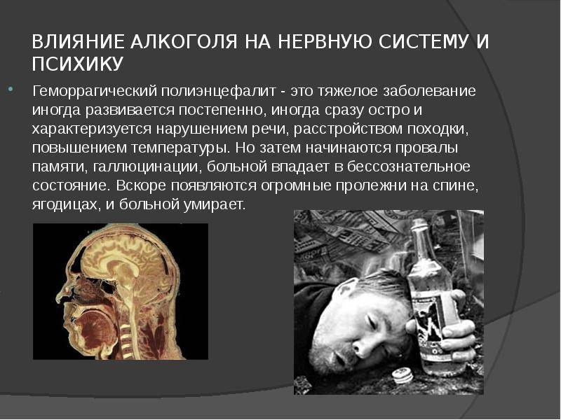 Регулярное влияние алкоголя на нервную систему — верный путь к деградации
