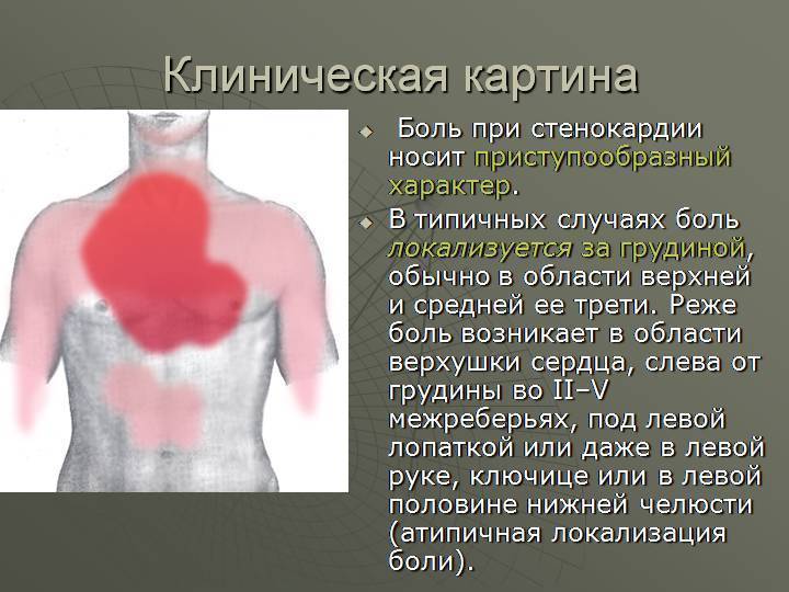 Почему после курения болят лёгкие pulmono.ru
почему после курения болят лёгкие